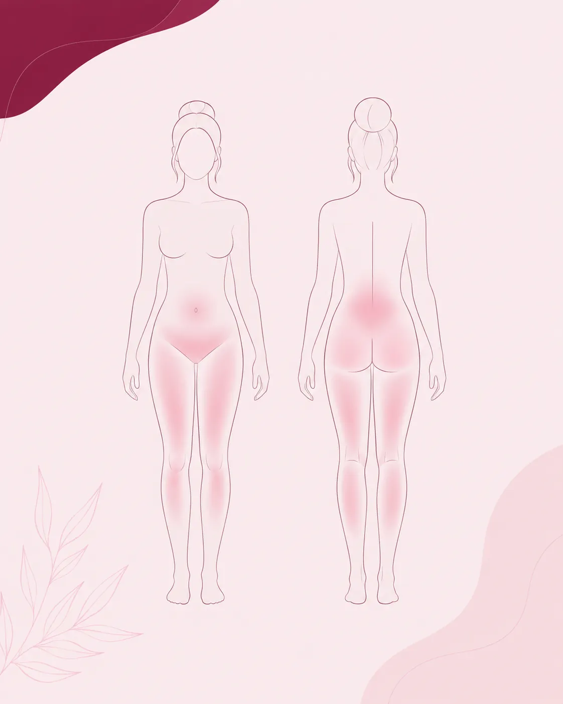 An illustration used to explain where pelvic pain can be felt